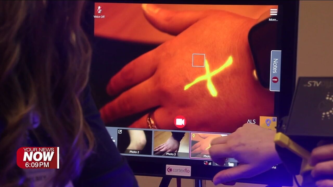 OhioHealth Van Wert Hospital rolls out new technology to help victims of sexual assault